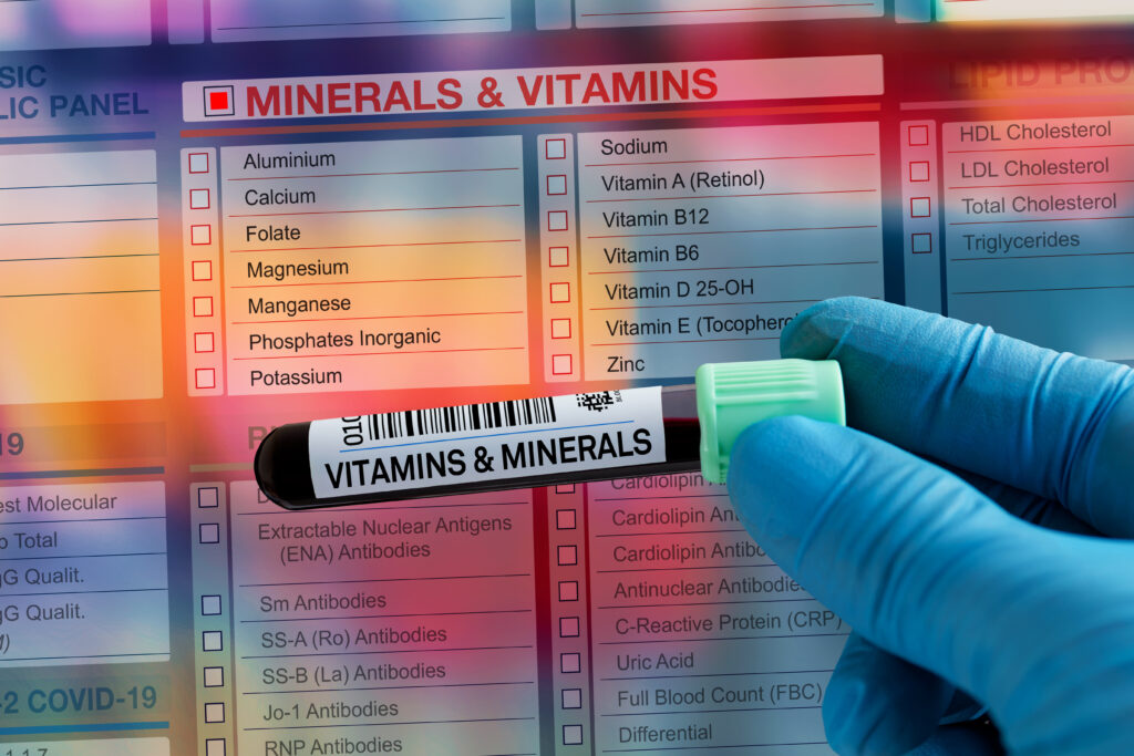 Nahaufnahme eines Blutprobenröhrchens mit der Aufschrift „Vitamins & Minerals“, gehalten von einer Hand in blauen Handschuhen vor einer Laboranforderungsliste mit verschiedenen Mineralien- und Vitaminwerten wie Magnesium, Zink, Vitamin D und Vitamin B12.