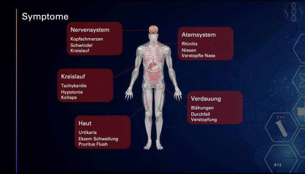 Grafik zu typischen Symptomen einer Histaminintoleranz: Nervensystem – Kopfschmerzen, Schwindel, Kreislaufprobleme; Atemsystem – Rhinitis, Niesen, verstopfte Nase; Kreislauf – Tachykardie, Hypotonie, Kollaps; Haut – Urtikaria, Ekzem, Schwellung, Juckreiz, Flush; Verdauung – Blähungen, Durchfall, Verstopfung. Anatomische Figur mit markierten betroffenen Bereichen.