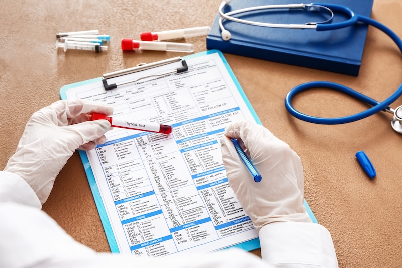 Laboranforderung für Blutwerte mit Schilddrüsenröhrchen – ganzheitliche Blutdiagnostik zur Ursachenfindung